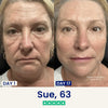 The Chiniva™ Lift Mask